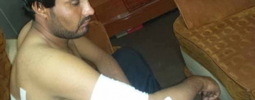 یک خبرنگار محلی در زابل با ضربات چاقو به شدت زخمی شد